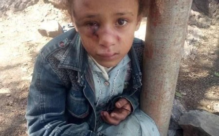 تعز..شخص يعتدي على ابنة أخيه ويحتجزها مع أمها ويمنع إسعافها