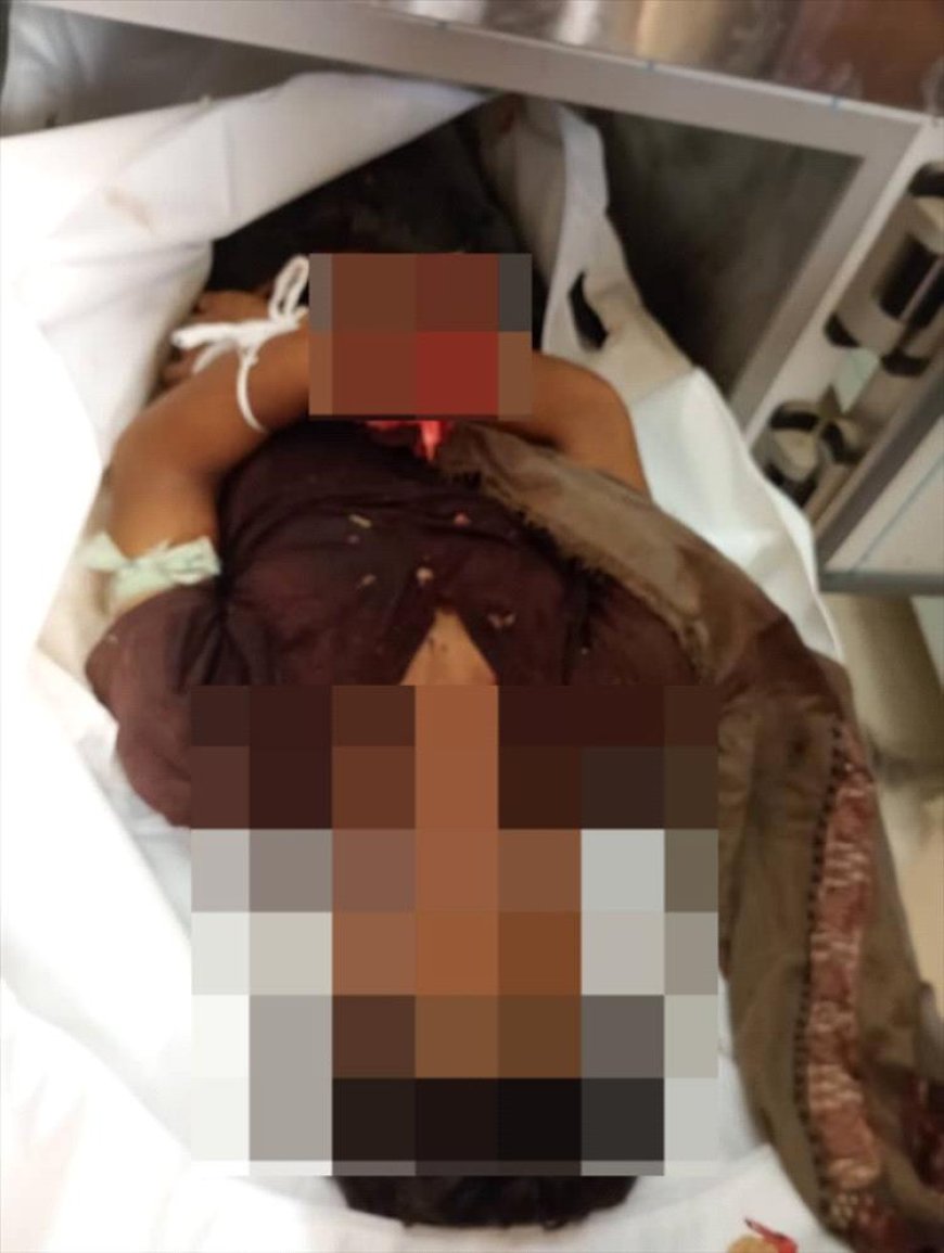 أبين.. مقتل شاب في مديرية لودر جراء إنفجار عبوة ناسفة في منزله
