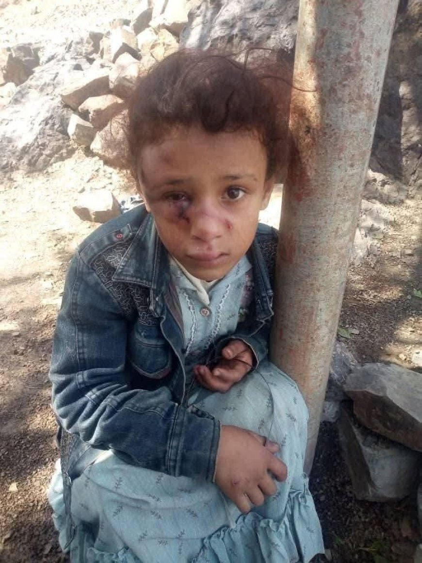 تعز..شخص يعتدي على ابنة أخيه ويحتجزها مع أمها ويمنع إسعافها