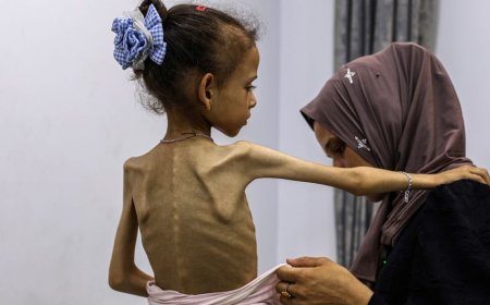 ازدياد عدد الوفيات في غزة بسبب المجاعة .. تقرير