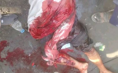 تعز.وقوع حادثة مأساوية بمنطقة مفرق يفرس الرابط بين جبل حبشي والمعافر.