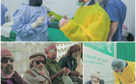 بتمويل مركز الملك سلمان وتنفيذ مؤسسة البصر الخيرية العالمية.. تدشين مخيم طبي جراحي للعيون بطور الباحة