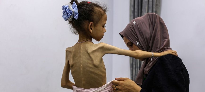 ازدياد عدد الوفيات في غزة بسبب المجاعة .. تقرير