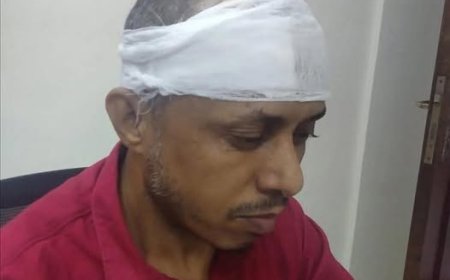 مسلح يعتدي على الصحفي صالح أبو عوذل في عدن