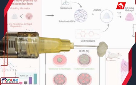 ابتكار (جل) ذكي يعيد الأمل لمصابي هذا المرض