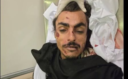 حادث غامض في صنعاء.. وفاة رجل مجهول دون أي وثائق تثبت هويته!