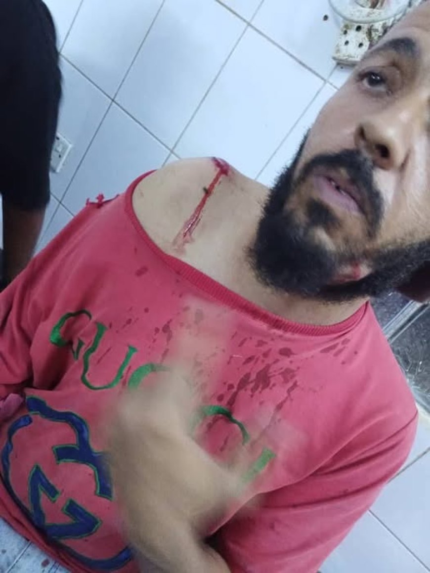 شرطة أبين تضبط شابًا أطلق النار على مواطن في جعار