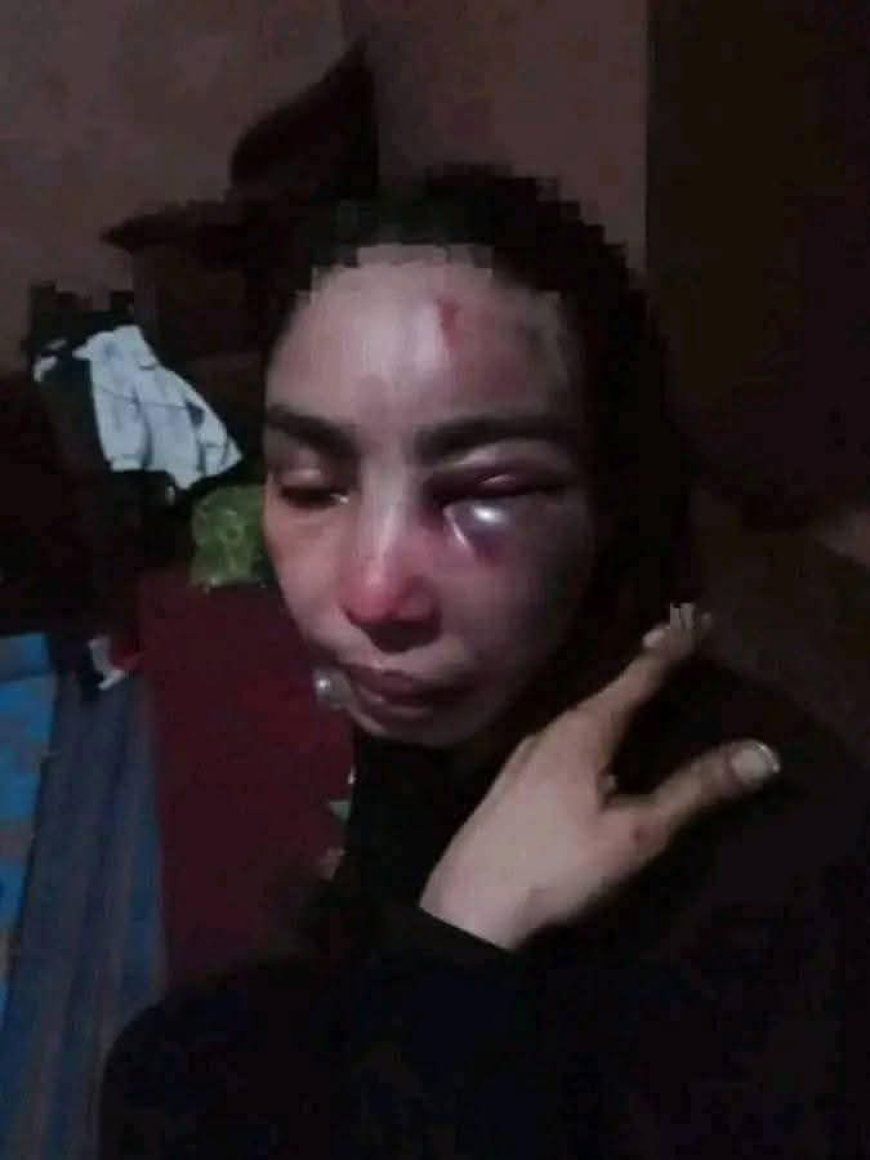 تعز .امرأة تُعذب بوحشية على يد طليقها العسكري أمام الناس فيها.