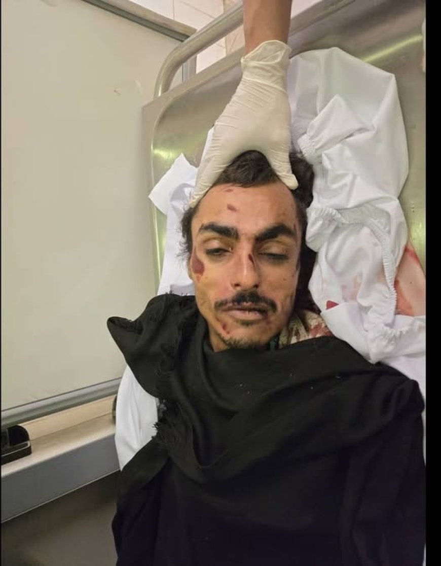 حادث غامض في صنعاء.. وفاة رجل مجهول دون أي وثائق تثبت هويته!