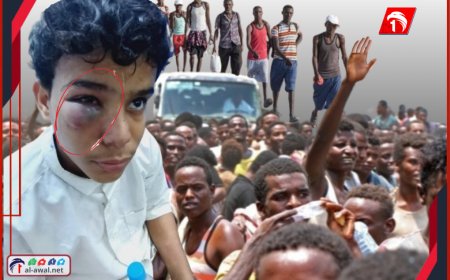 تفاصيل صادمة!!.. من أمام إدارة الأمن (أفارقة مهاجرين) يعتدون على طفل متسببين بإصابات خطيرة