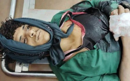 تفاصيل جديدة من اشتباكات قاعة الأعراس في تعز.. قتيل وإصابات!