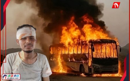 كسر الزجاج من قلب النار!!..  الناجي من كارثة حتراق حافلة أبين يروي تفاصيل اللحظات الأولى 