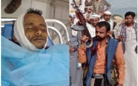 دم  بطعم العنب!!.. مأساة أب تهامي قتله الحوثيون لأنه دافع عن ابنه!