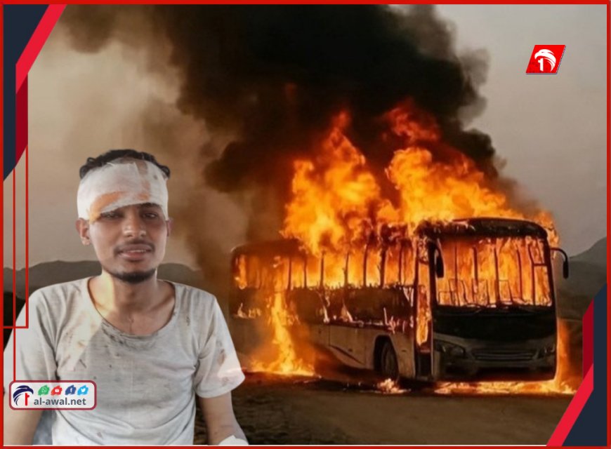 كسر الزجاج من قلب النار!!..  الناجي من كارثة حتراق حافلة أبين يروي تفاصيل اللحظات الأولى 