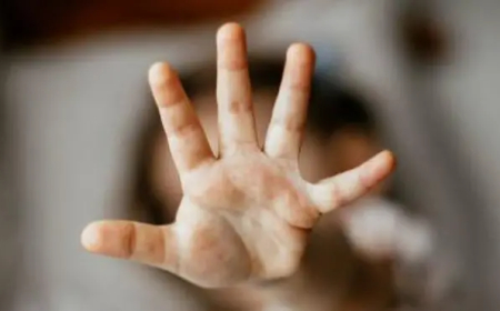 في بلد تحفظ فيه الحقوق .. فضيحة مدوية(  الاعتداء على 26 طفلا  في حضانات) .. تفاصيل