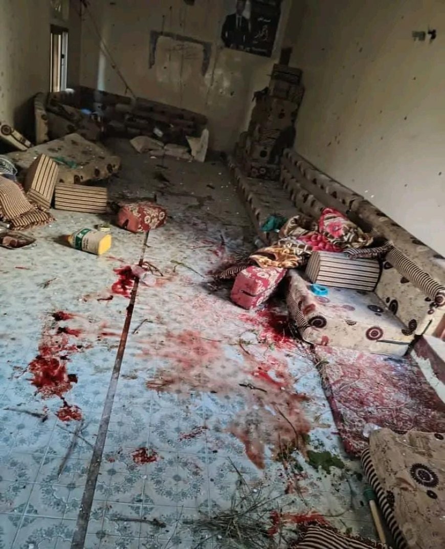 عاجل:  تعز..تفاصيل جديدة ننفرد بها قنبلة يدوية تُستهدف مجلس منزل في جبل حبشي وتُسفر عن إصابات خطيرة