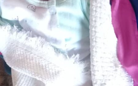 أسرة معدمة من أبين تناشد الخيرين مساعدتها لإجراء عملية جراحية مستعجلة لطفلتها المولودة بتشوه خلقي