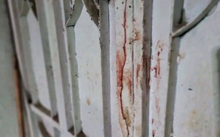 تعز..وحشية11 طعنة تهزها. سفاح عائد من السجن يذبح شاب داخل سوق المركزي