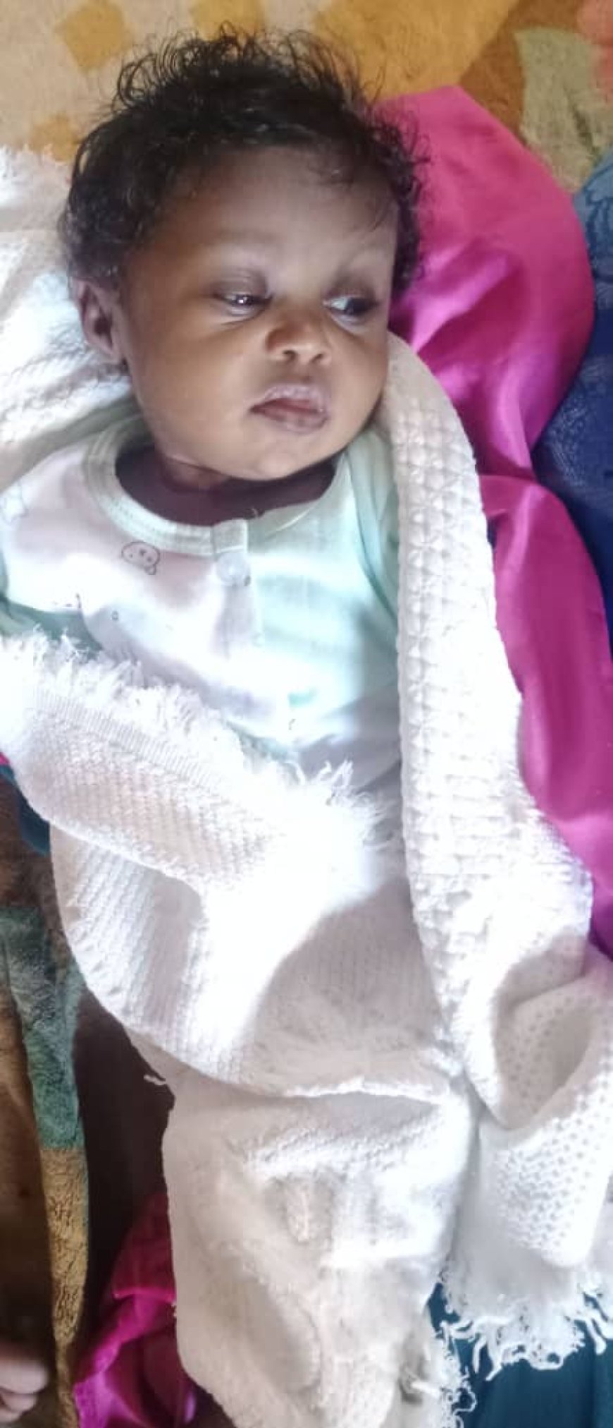 أسرة معدمة من أبين تناشد الخيرين مساعدتها لإجراء عملية جراحية مستعجلة لطفلتها المولودة بتشوه خلقي