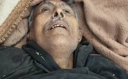 تعز..بعد استهداف طالب وامرأة.. قناصة المليشيا تقتل مسنا وتواصل حصد أرواح المدنيين فيها