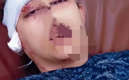 بعد مشاجرتهما .. زوج  في بلد عربي يعاقب زوجته بقطع أذنها .. ما السبب ؟