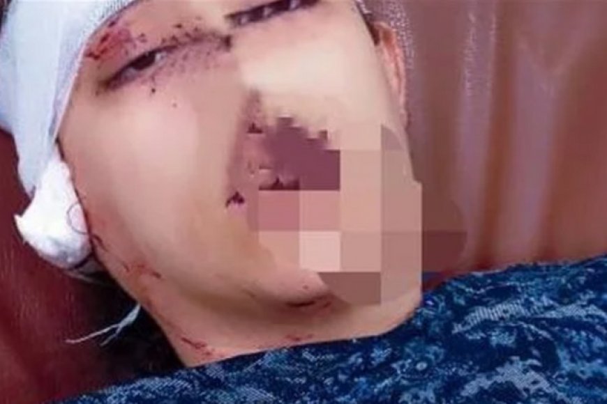 بعد مشاجرتهما .. زوج  في بلد عربي يعاقب زوجته بقطع أذنها .. ما السبب ؟