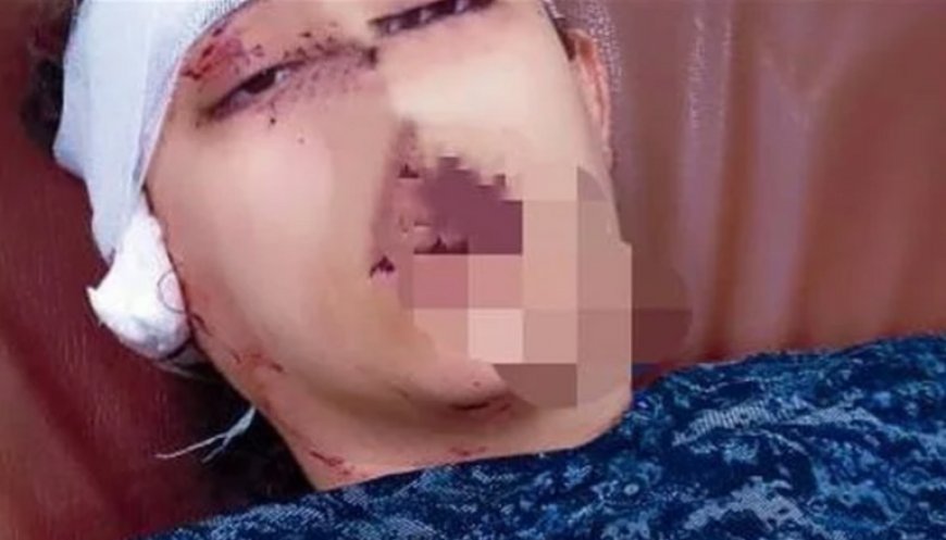 بعد مشاجرتهما .. زوج  في بلد عربي يعاقب زوجته بقطع أذنها .. ما السبب ؟