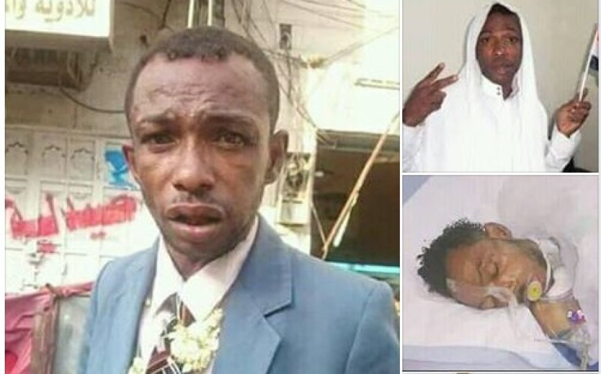 ​كارثة إنسانية تذكر بمأساة (التمباكي)!.. (وقود الطائرات) يحصد حياة شابين في عدن