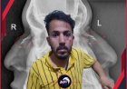 بالصورة!.. تفاصيل جديدة وصادمة وراء الاعتداء على حكم مباراة ديربي صنعاء
