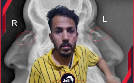 بالصورة!.. تفاصيل جديدة وصادمة وراء الاعتداء على حكم مباراة ديربي صنعاء