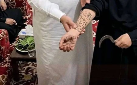 غضب في إب اليمنية عقب استغلال معالج بالرقية مريضات "لأغراض دعائية"