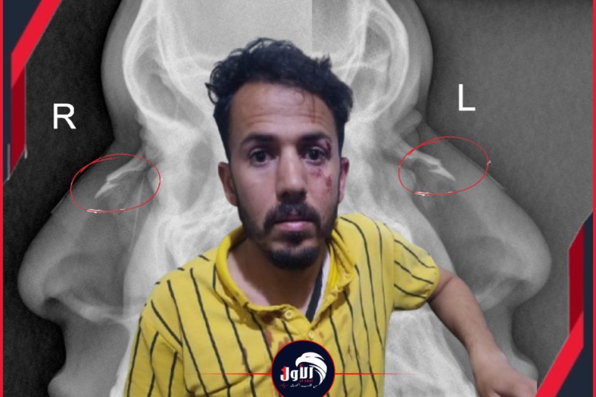 بالصورة!.. تفاصيل جديدة وصادمة وراء الاعتداء على حكم مباراة ديربي صنعاء