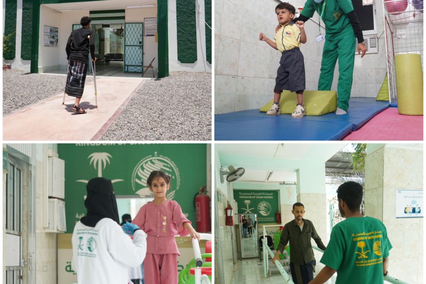 مركز الأطراف الصناعية بعدن يُقدم خدماته لـ(659) مستفيدًا خلال أبريل الماضي