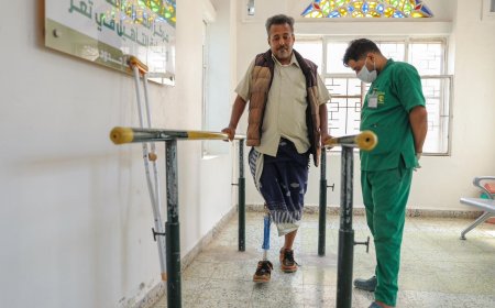 مركز الأطراف الصناعية بتعز يقدم خدماته الطبية لـ (576) مستفيدًا خلال يونيو الماضي