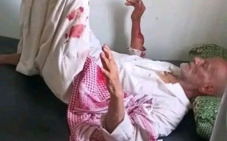 جريمة مروعة تهز مديرية مقبنة بتعز.. مسن يتعرض لاعتداء وحشي أسفر عن بتر إصبعه وإصابته بطعنات خطيرة