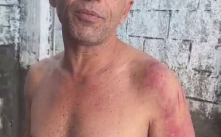 تعز.. مواطن يكشف تعرضه للاختطاف والتعذيب ويتهم شقيق قائد عسكري باستغلال النفوذ