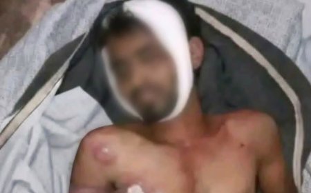 الموت تحت التعذيب في معتقل "مدينة الصالح".. وفاة شاب من شرعب السلام تفجر مطالبات بتحقيق دولي ومحاسبة المسؤولين