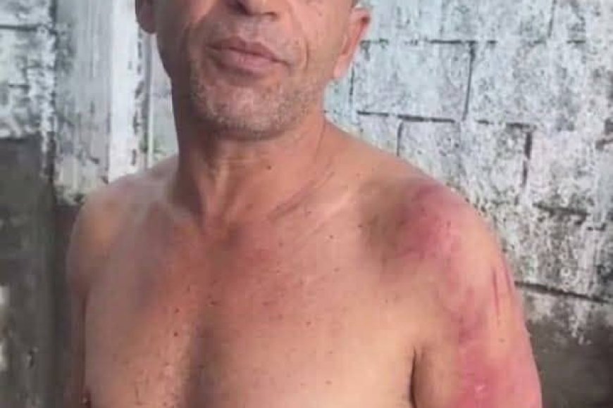تعز.. مواطن يكشف تعرضه للاختطاف والتعذيب ويتهم شقيق قائد عسكري باستغلال النفوذ