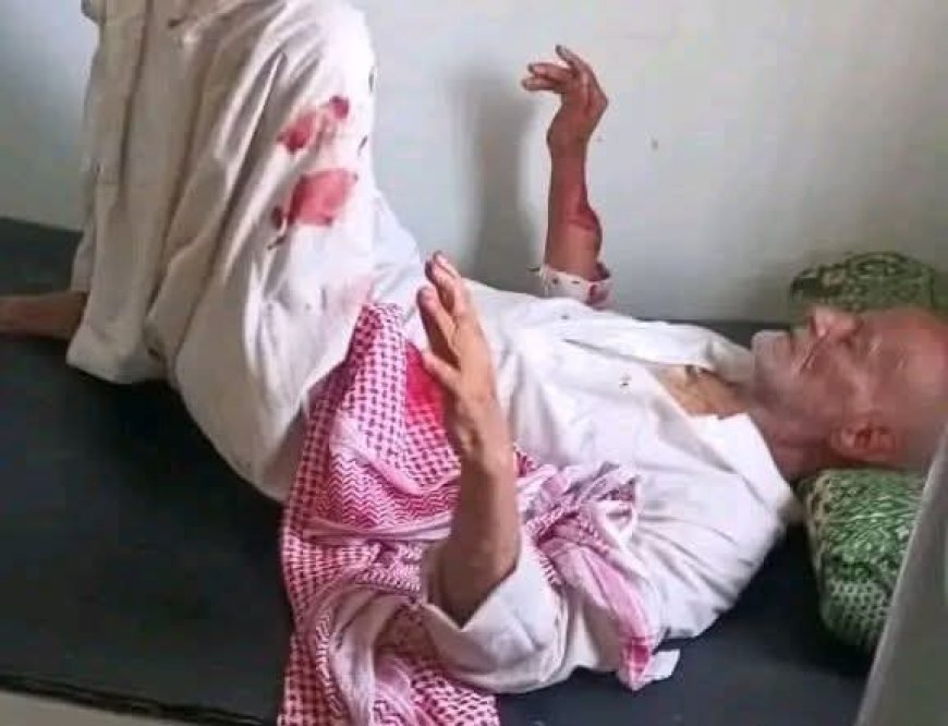 جريمة مروعة تهز مديرية مقبنة بتعز.. مسن يتعرض لاعتداء وحشي أسفر عن بتر إصبعه وإصابته بطعنات خطيرة