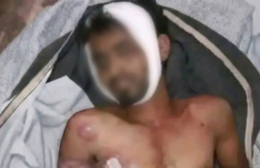 الموت تحت التعذيب في معتقل "مدينة الصالح".. وفاة شاب من شرعب السلام تفجر مطالبات بتحقيق دولي ومحاسبة المسؤولين