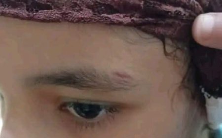 صدمة في تعز.. مطالبات عاجلة بالتحقيق في بلاغات عن تعذيب أطفال على يد زوجة والدهم في المواسط