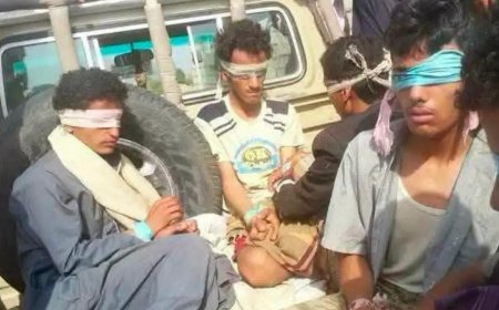 القوات المسلحة تحبط تسللاً حوثياً في جبهة الكريفات شرقي تعز وتعتقل عدداً من عناصر المليشيا