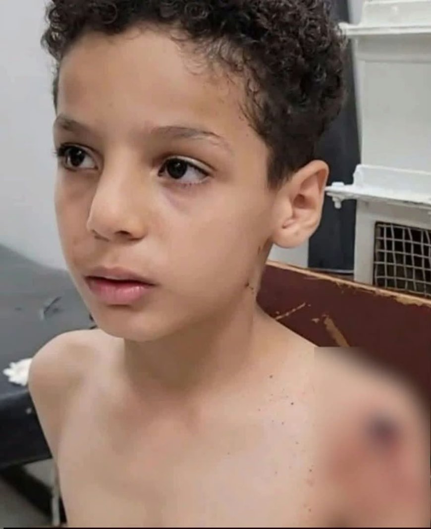 إصابة طفل (10 أعوام) بشظية في تعز جراء قصف حوثي على حي سكني