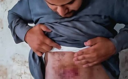 أسرة سجين في صعدة تتهم إدارة إصلاحية قحزة بتعذيبه.. وتطالب بتحقيق مستقل