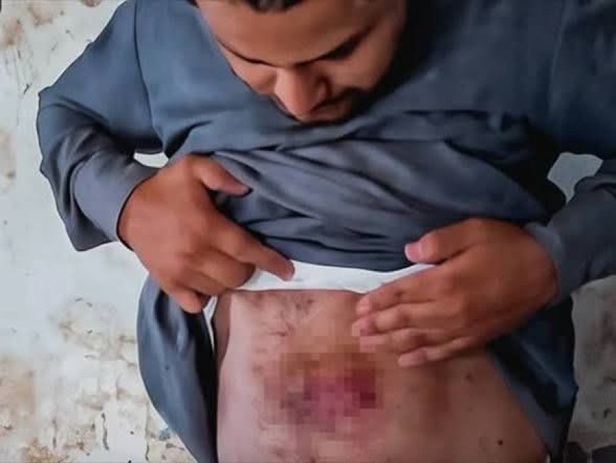 أسرة سجين في صعدة تتهم إدارة إصلاحية قحزة بتعذيبه.. وتطالب بتحقيق مستقل